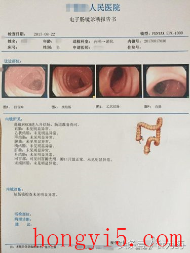 做了无痛肠镜很后悔(无痛肠镜)插图8