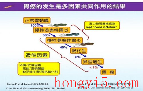 胃病严重程度排名前十(胃癌只是左上腹一阵一阵疼)插图1