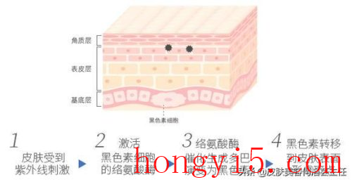 面部七种斑的图片(肝斑长在脸上哪个部位)插图1