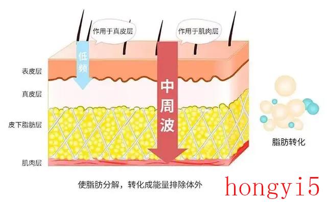 1000个跳绳大概消耗多少卡路里（1000个跳绳消耗多少卡路里）(图4)