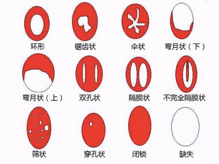 女人的第一次，女人第一次会痛、会流血